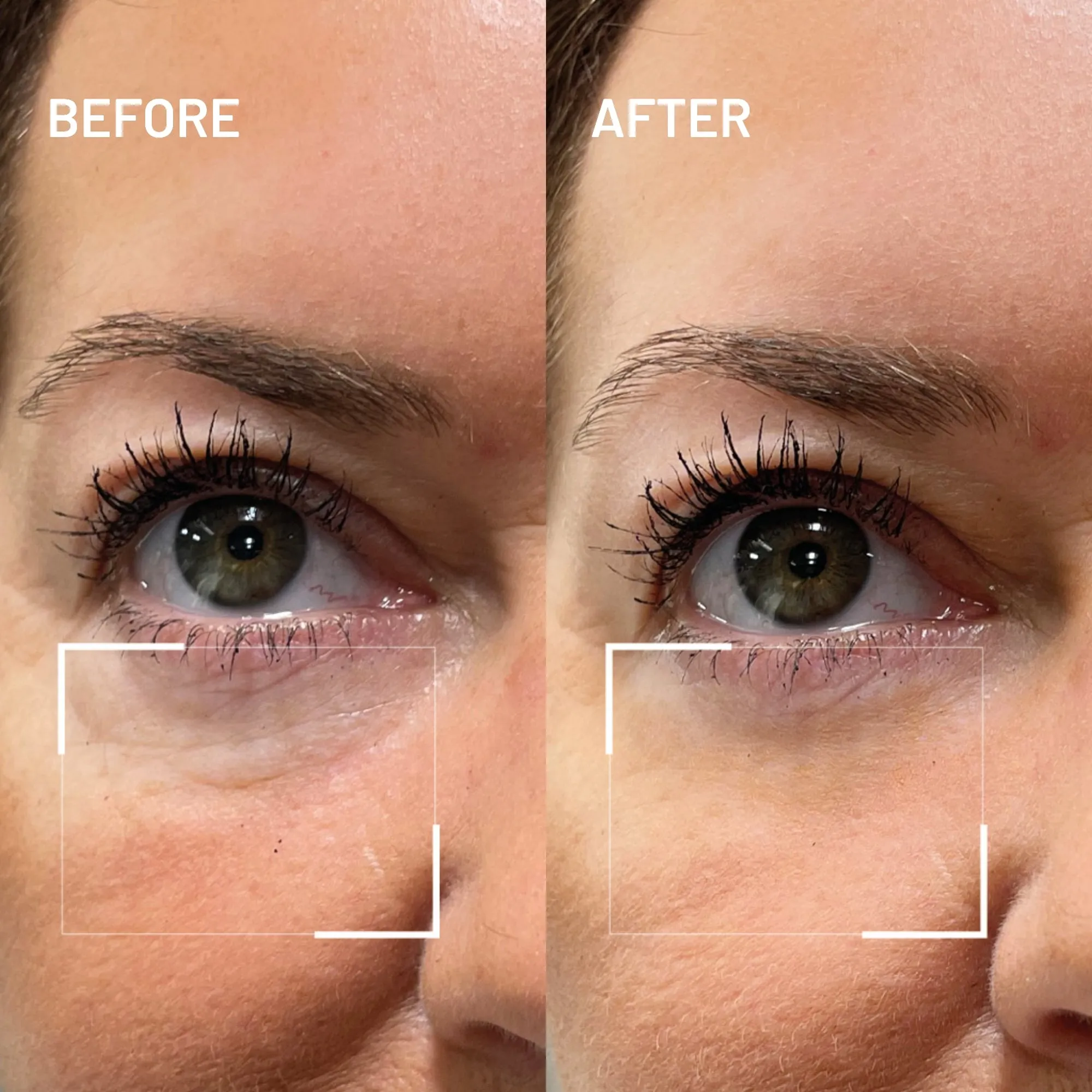 BYE BYE DARK CIRCLES EYE DUO